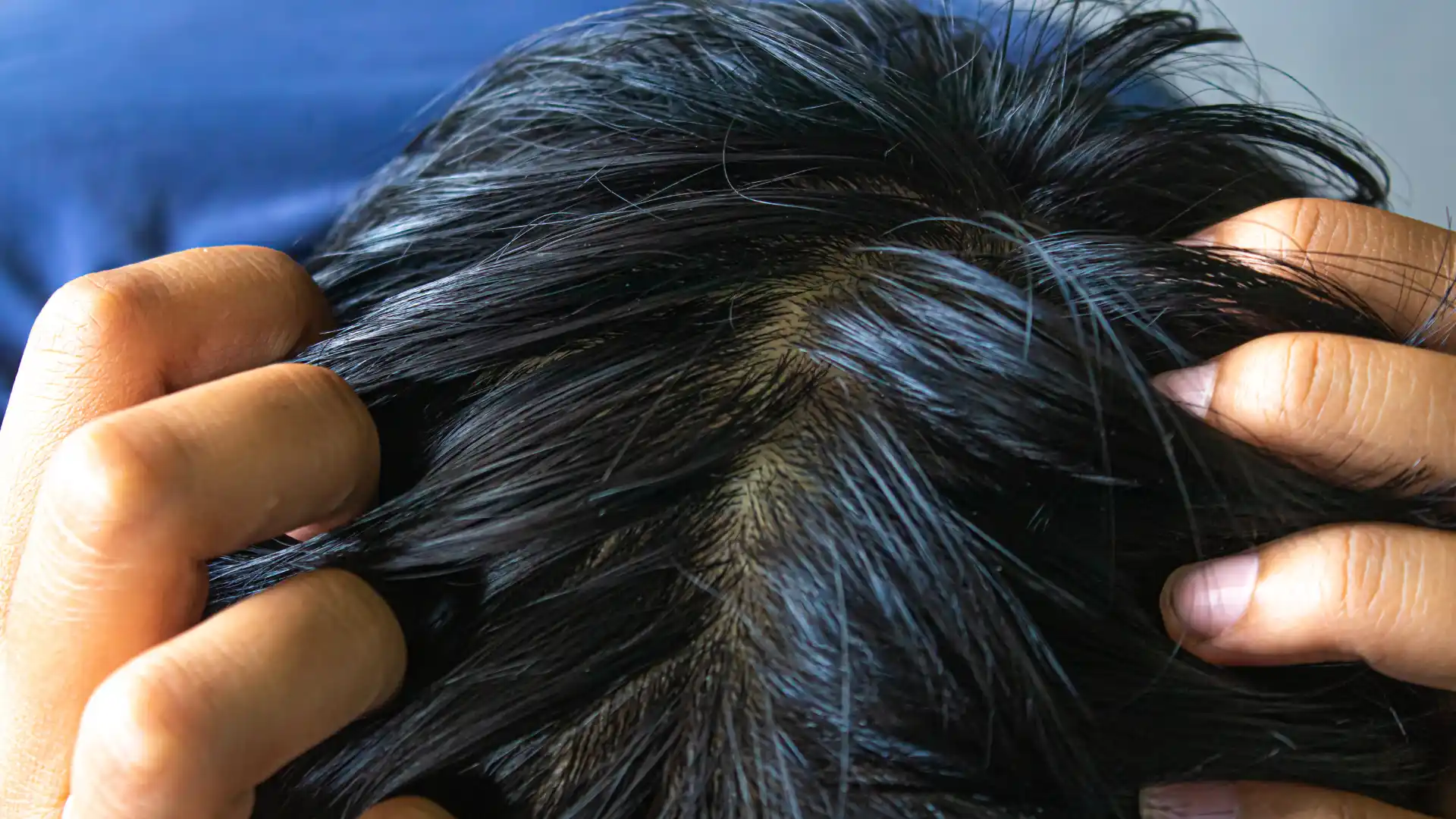How Scalp Health Affects Hair Growth_ What Stylists Wish You Knew image 2